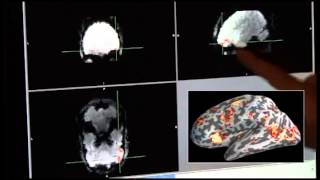 rtfMRI Neurofeedback – Cigarette smoking Cessation